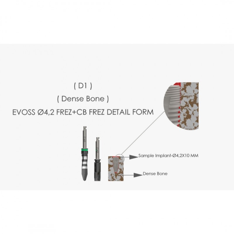 EVOPLUS 4.0x11.5mm - 7