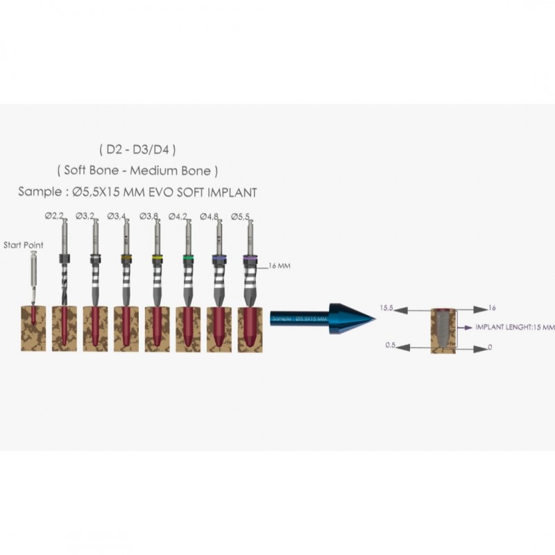 EVOSOFT 3.4x7mm - 4